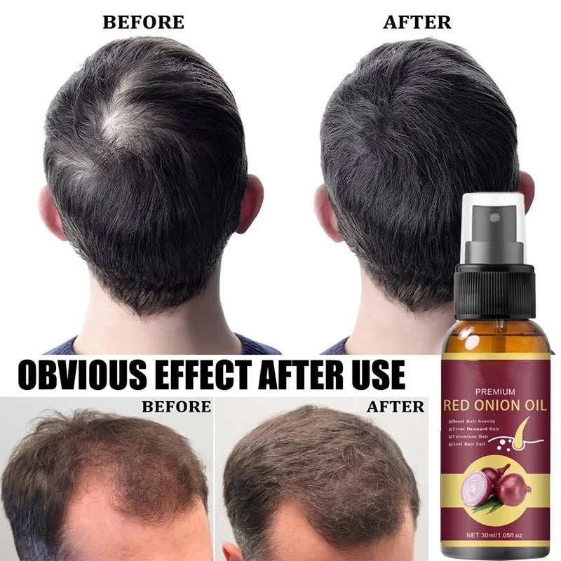 Hair Growth Serum Spray Repair Nourish Hair Roots Hair Regrowth Anti-hair Loss Treatment Men Women Hair Care