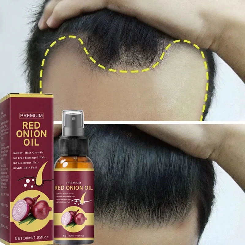 Hair Growth Serum Spray Repair Nourish Hair Roots Hair Regrowth Anti-hair Loss Treatment Men Women Hair Care