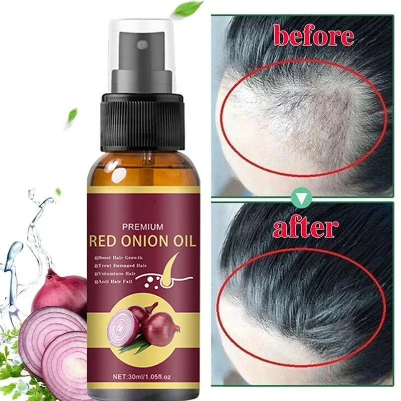 Hair Growth Serum Spray Repair Nourish Hair Roots Hair Regrowth Anti-hair Loss Treatment Men Women Hair Care